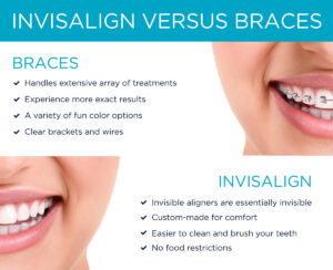 The alignment of teeth braces and invisible aligners.