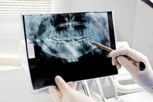 Dental X-rays